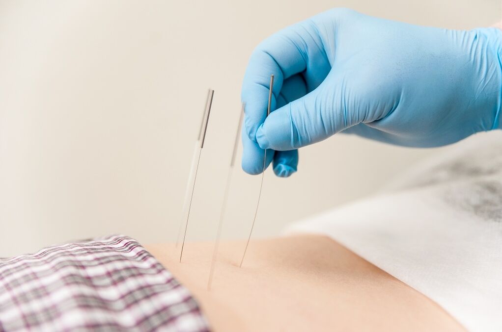 Thoracesch Osteochendrosis Behandlung